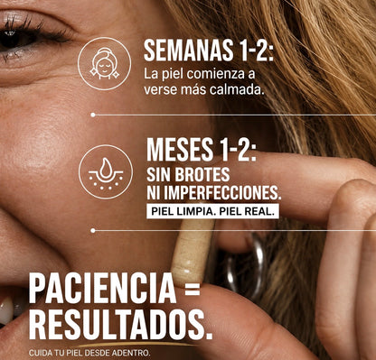 CLEARADVANCE™-Elimina el acné hormonal