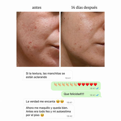 CLEARADVANCE™- Antiacné